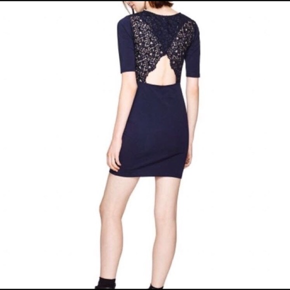 Aritzia Talula lace open back dress - Picture 1 of 4